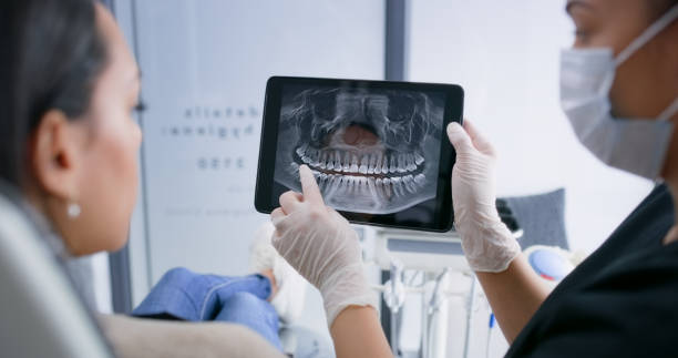 Best Emergency Wisdom Tooth Extraction in Burbank, CA