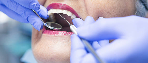 Best Emergency Cosmetic Dentistry (e.g., broken veneers) in Burbank, CA